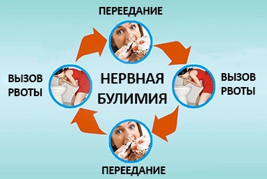 Лечение булимии в Кеми